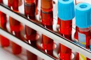 Как подготовиться к операции 