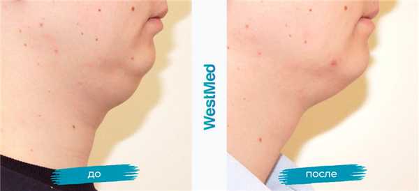 подбородок