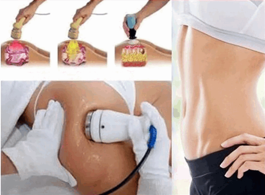 ультразвуковая липосакция противопоказания, кавитация ультразвуковая липосакция цена, ультразвуковая липосакция живота цена москва, ультразвуковая липосакция методом кавитации, ультразвуковая липосакция коленей, ультразвуковая липосакция краснодар, ультразвуковая кавитационная липосакция, ультразвуковая липосакция ляшек, ожоги после ультразвуковой липосакции, ультразвуковая липосакция отзывы реальные, сколько стоит ультразвуковая липосакция, ультразвуковая липосакция живота отзывы форум, ультразвуковая липосакция видео