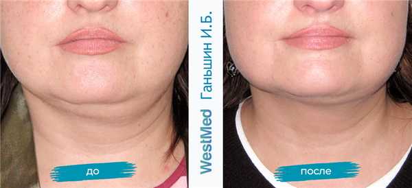 подбородок