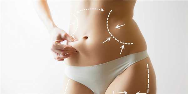 виды липосакции