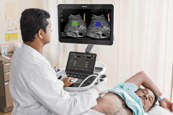 Эластография сдвиговой волной