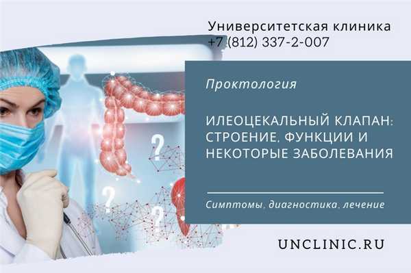 You are currently viewing Илеоцекальный клапан: строение, функции и некоторые заболевания
