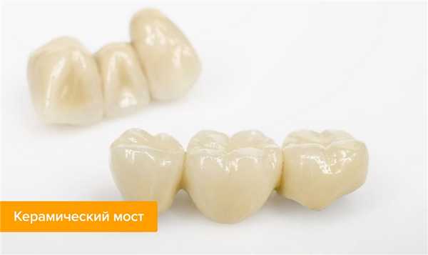 Фото керамического моста