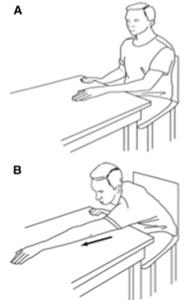 упражнения после артроскопии