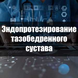 Эндопротезирование тазобедренного сустава