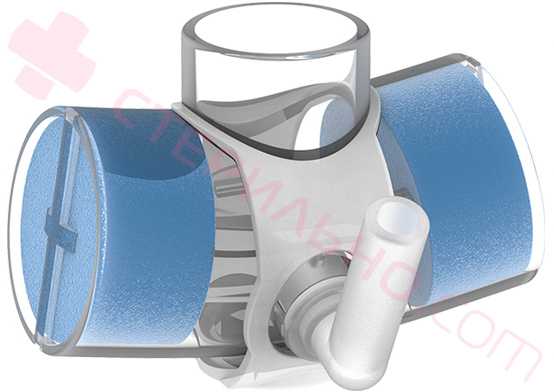 Трахеостома у детей