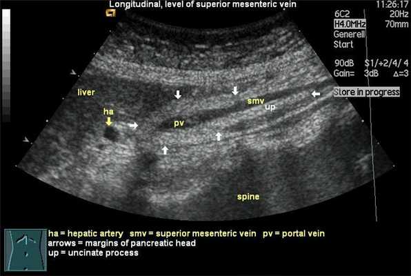 УЗИ поджелудочной железы