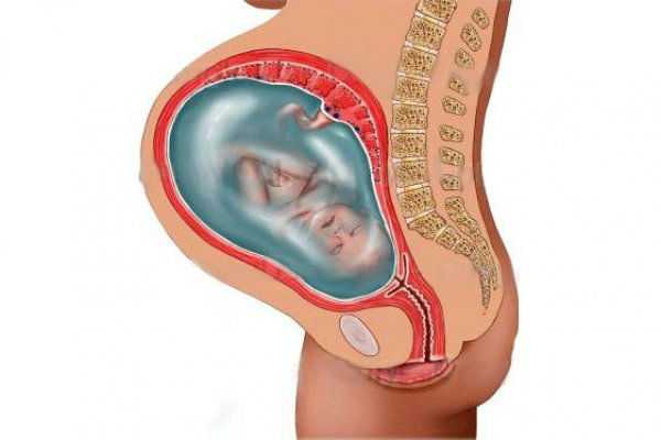 Беременность