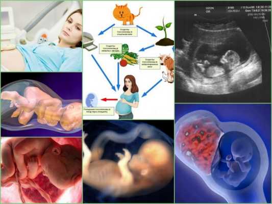 Причины врожденной косолапости у ребенка