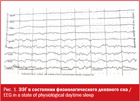 ЭЭГ в состоянии физиологического дневного сна