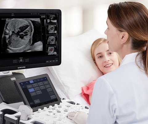 Агенезия мозолистого тела