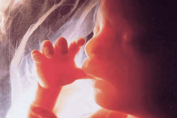 Гидроцефалия - серьёзная патология плода, обнаруживаемая на УЗИ