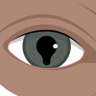 Колобома глаза