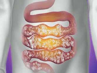 Если были не соблюдены правила подготовки, то газы в кишечнике могут помешать дать четкую картину