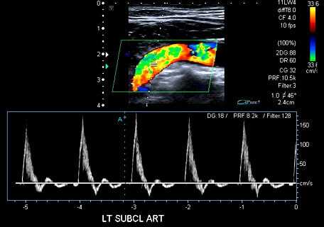 УЗИ артерий