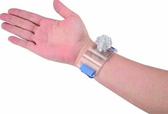 Устройство для закрытия радиального доступа