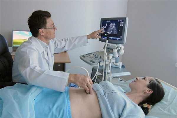 Патологии передней брюшной стенки плода