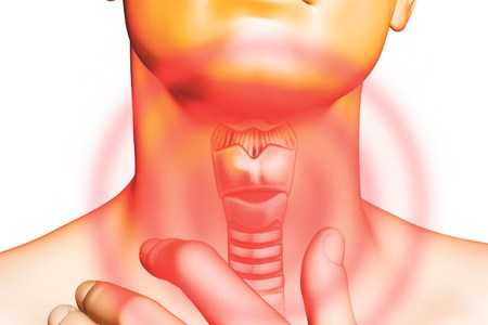 Факторы риска