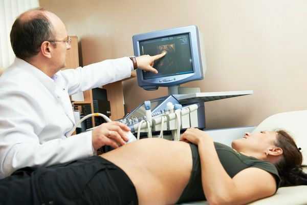 УЗИ у беременной