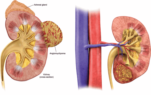 Ультразвуковое исследование мочевыводящих путей