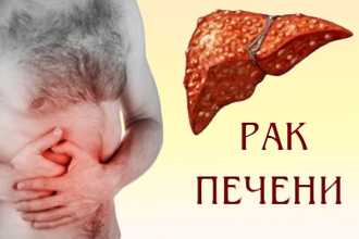 Злокачественные опухоли