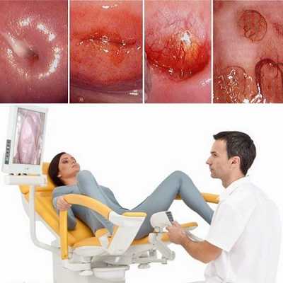 Как выглядят кисты на шейке матки на УЗИ, фото