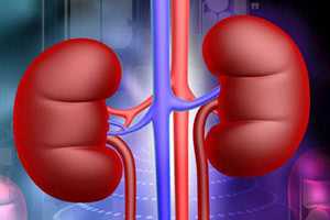 Пример дистопии почки