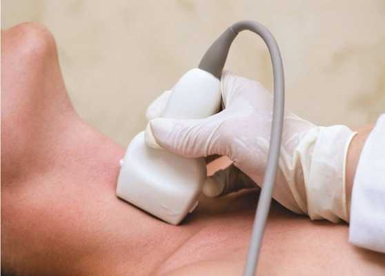 Проведение УЗДГ брахиоцефальных артерий