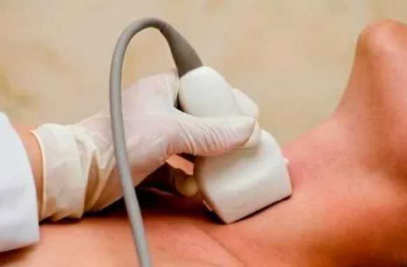 Ультразвуковое исследование лимфатических узлов шеи