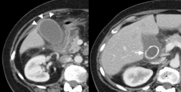 Снимок экрана 2016-04-20 в 21.53.05