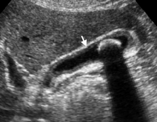 Снимок экрана 2016-04-20 в 21.53.20