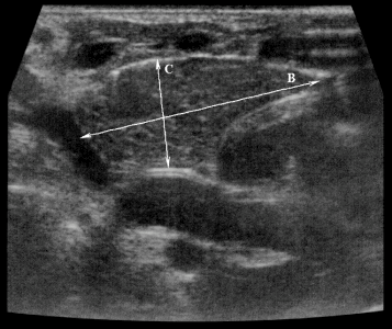 Тимус продольный ПД