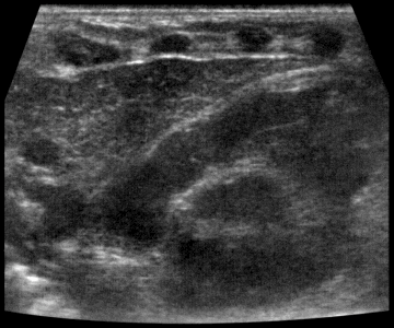 Тимус продольный ЛД