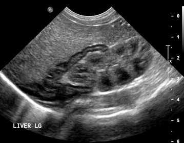 Тимус у разного возраста