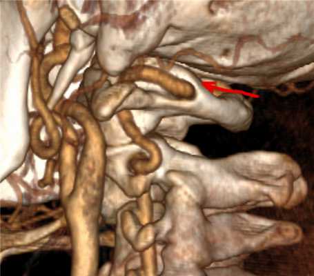 Аномалия Киммерли
