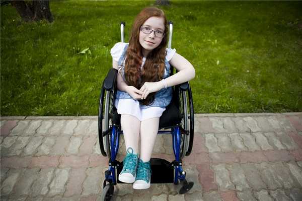 Несовершенный остеогенез у детей