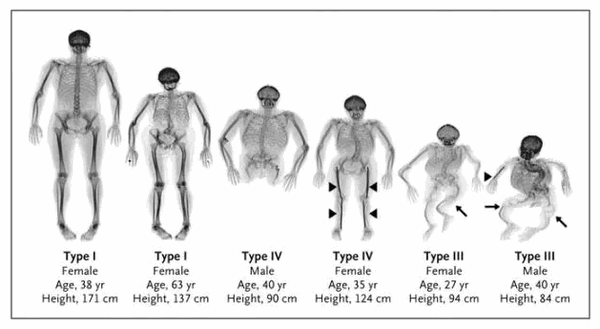 Классификация заболевания
