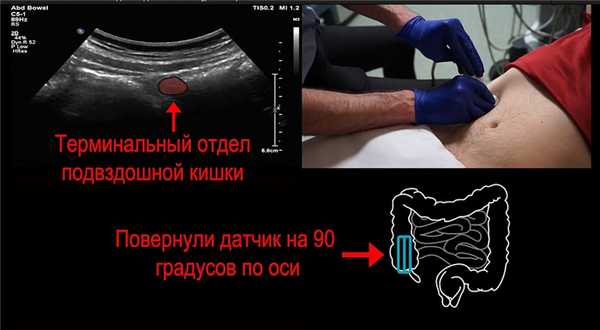 Поворачиваем датчик на 90 градусов по оси