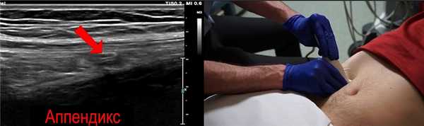 Для лучшего контроля вращайте датчик двумя руками