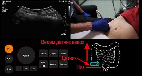 Затем начинаем поднимать датчик вверх для поиска терминального отдела
