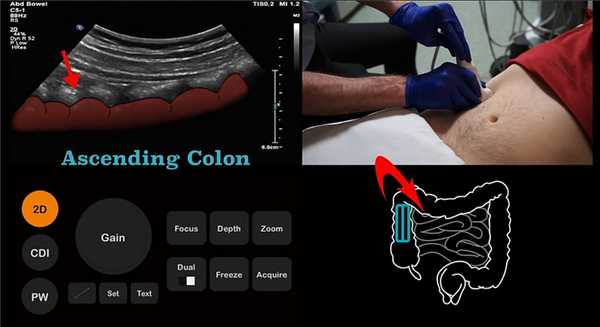 Ориентируемся на хауструм имеющий дольчатый контур
