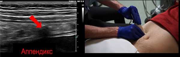 Акустическая тень из-за газов