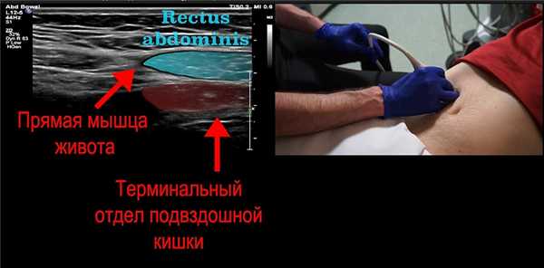 Вы можете улучшить изображение надавив на мягкие ткани