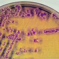 Дисбиоз кишечника