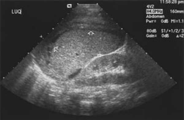 узи желудка брюшная полость