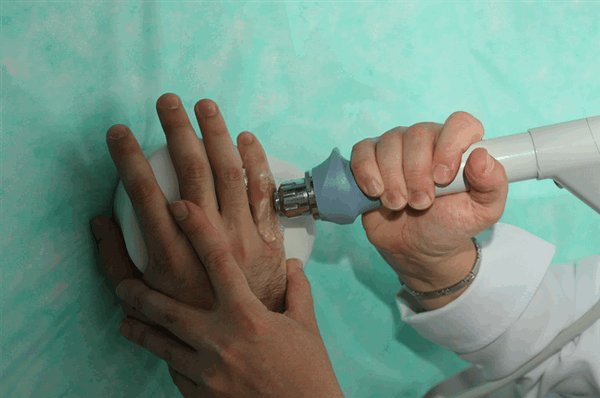 физиотерапия узелки Бушара