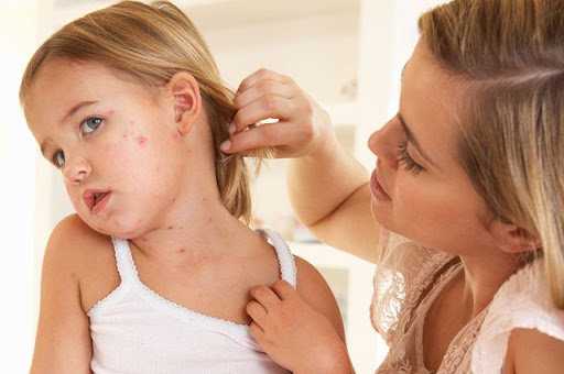 Чем опасны корь, краснуха и паротит?