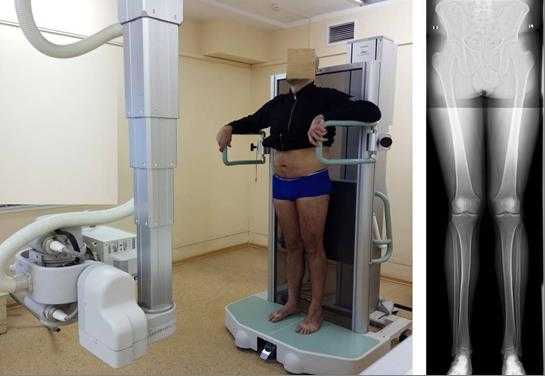 рентгеновская топограмма 