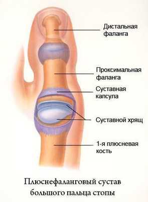 Плюснефаланговый сустав